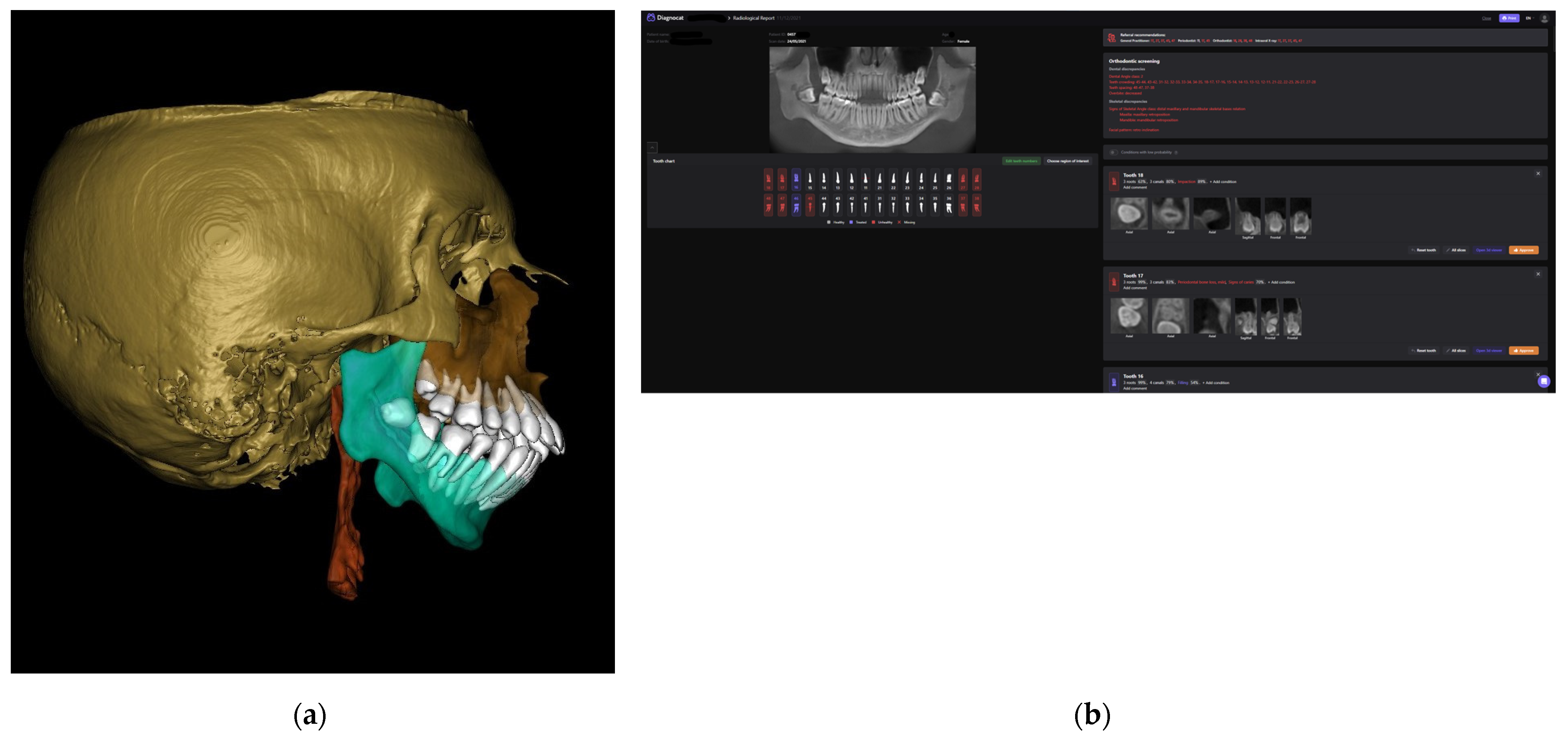 Electronics 12 01710 g006
