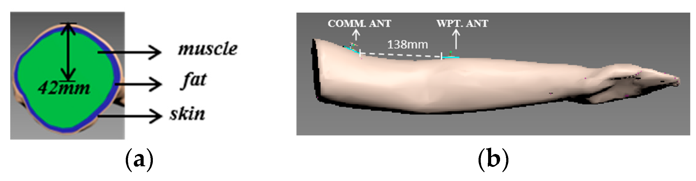 Electronics 12 01758 g004
