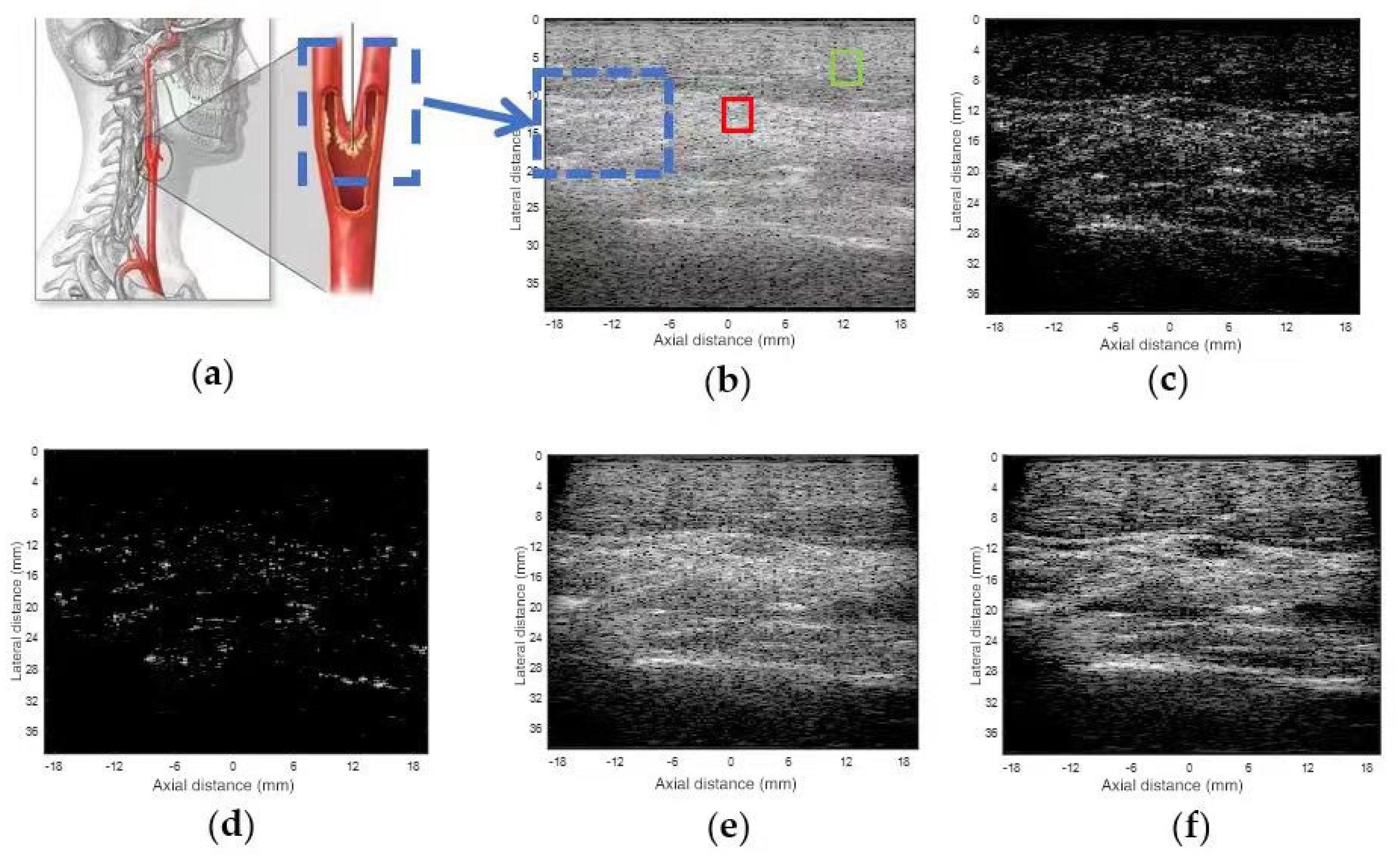 Electronics 12 03902 g009
