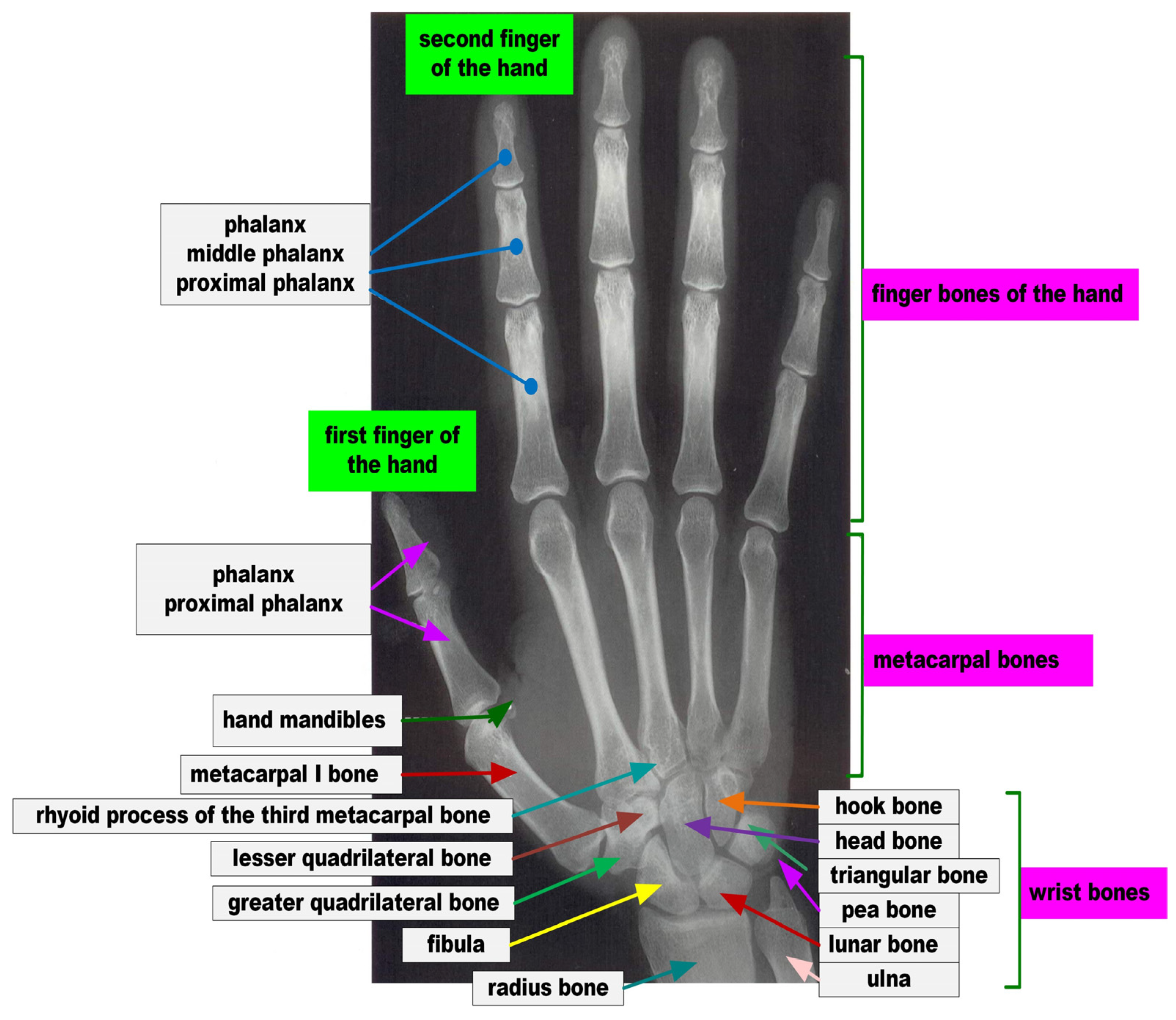 Electronics 13 00325 g005