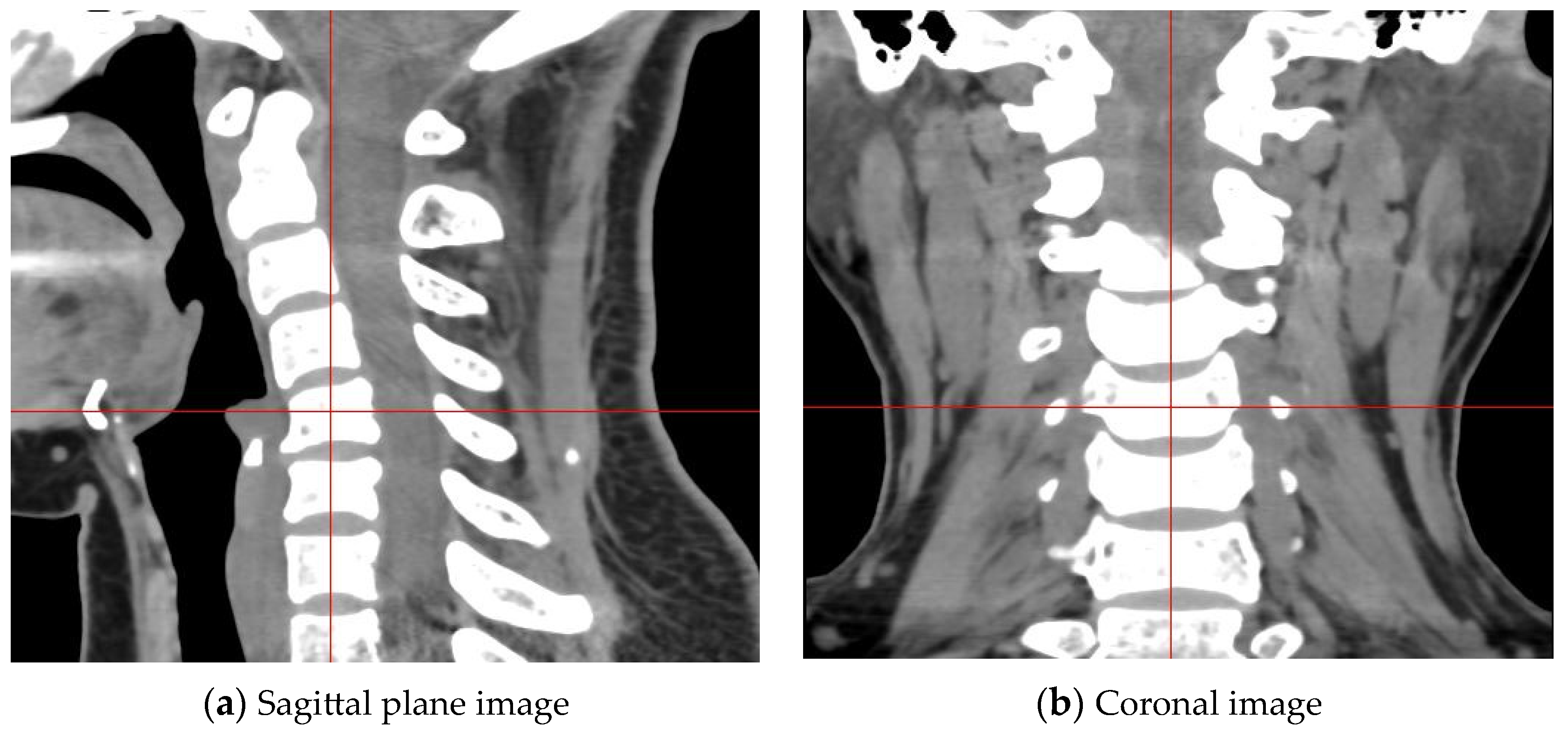 Electronics 13 00432 g007