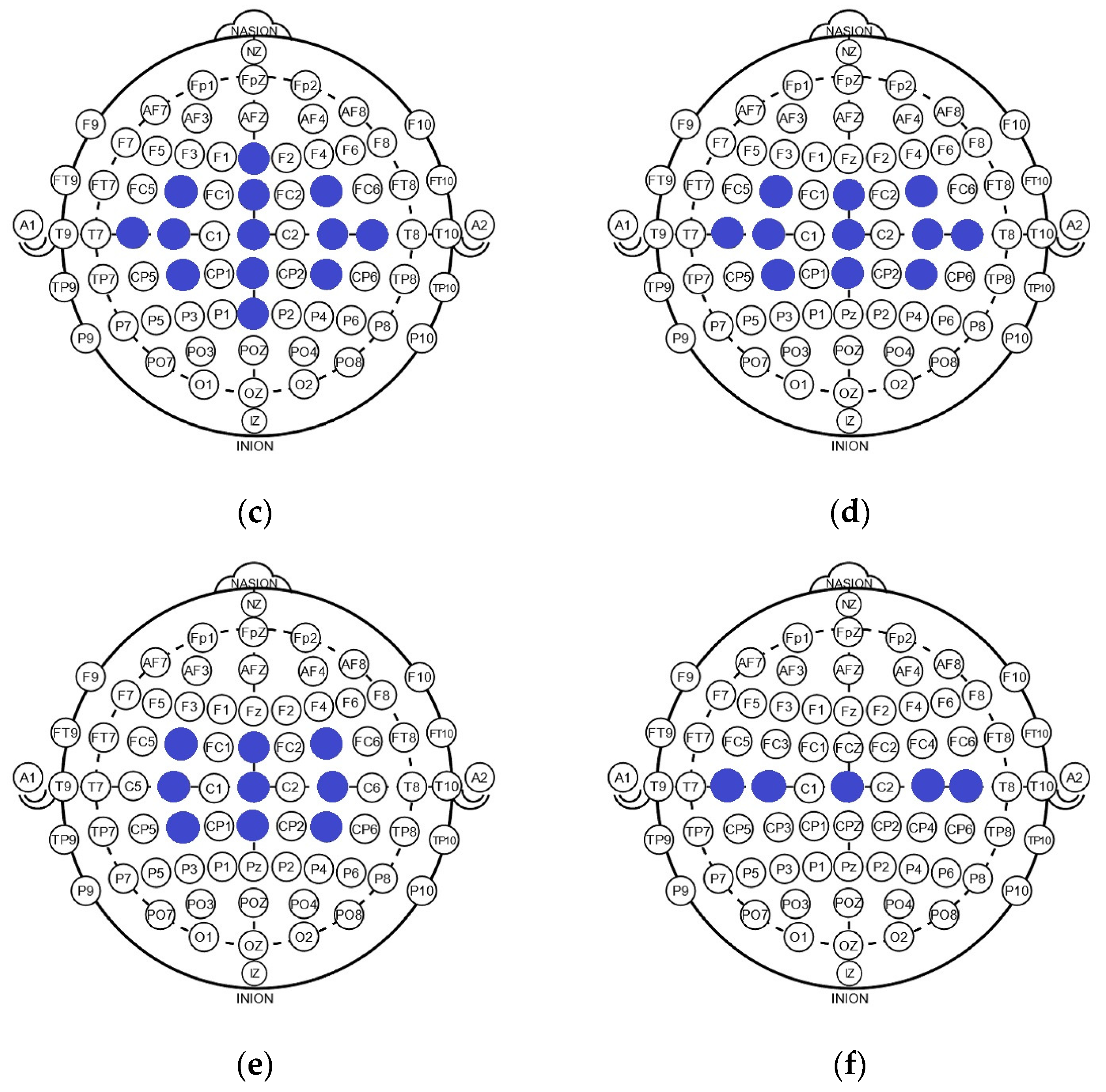 Electronics 13 00565 g006b