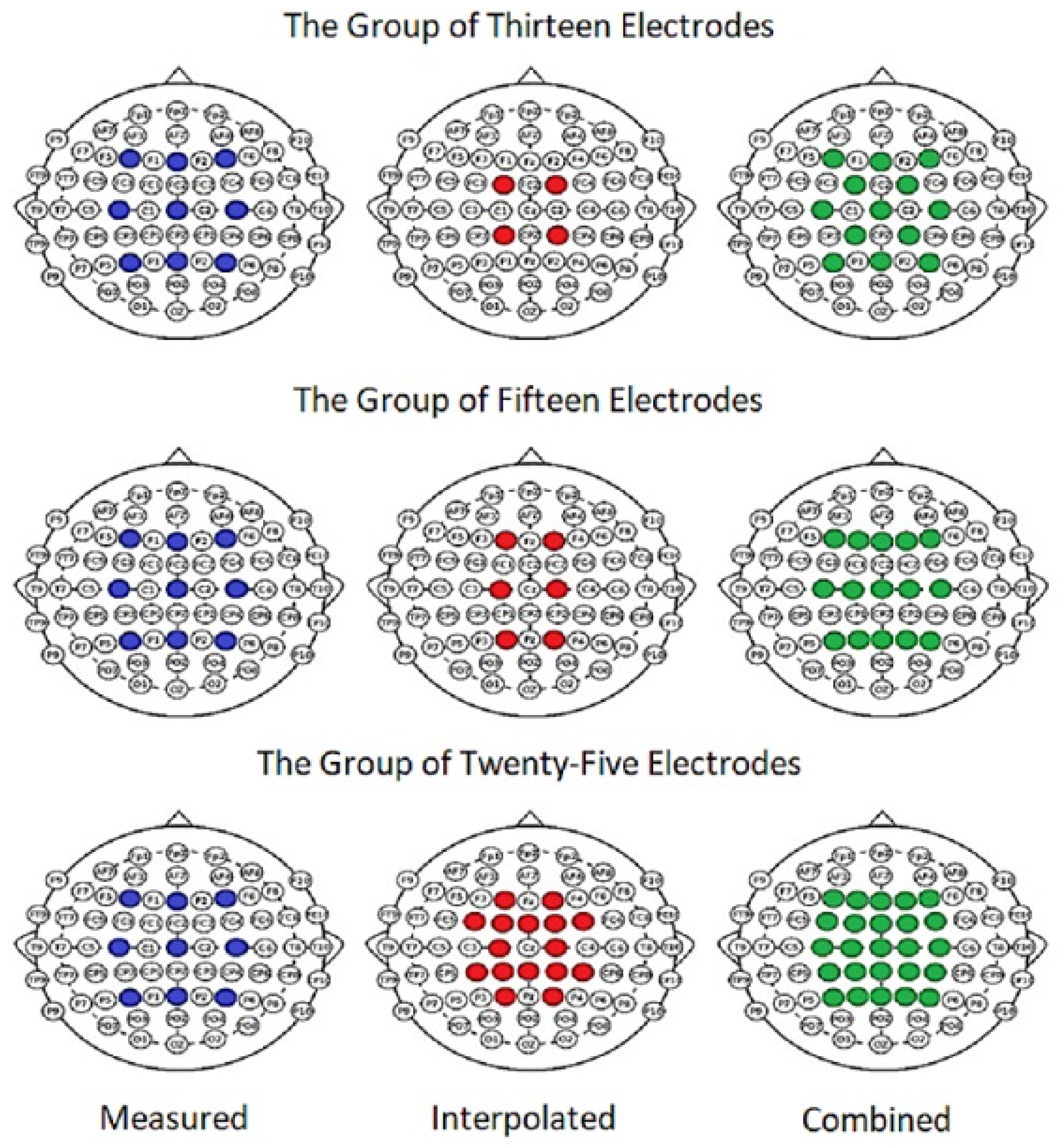 Electronics 13 00565 g013