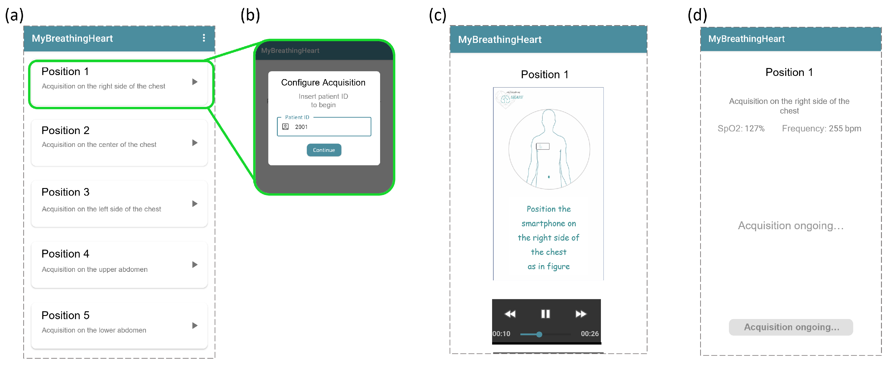 Electronics 13 01132 g004