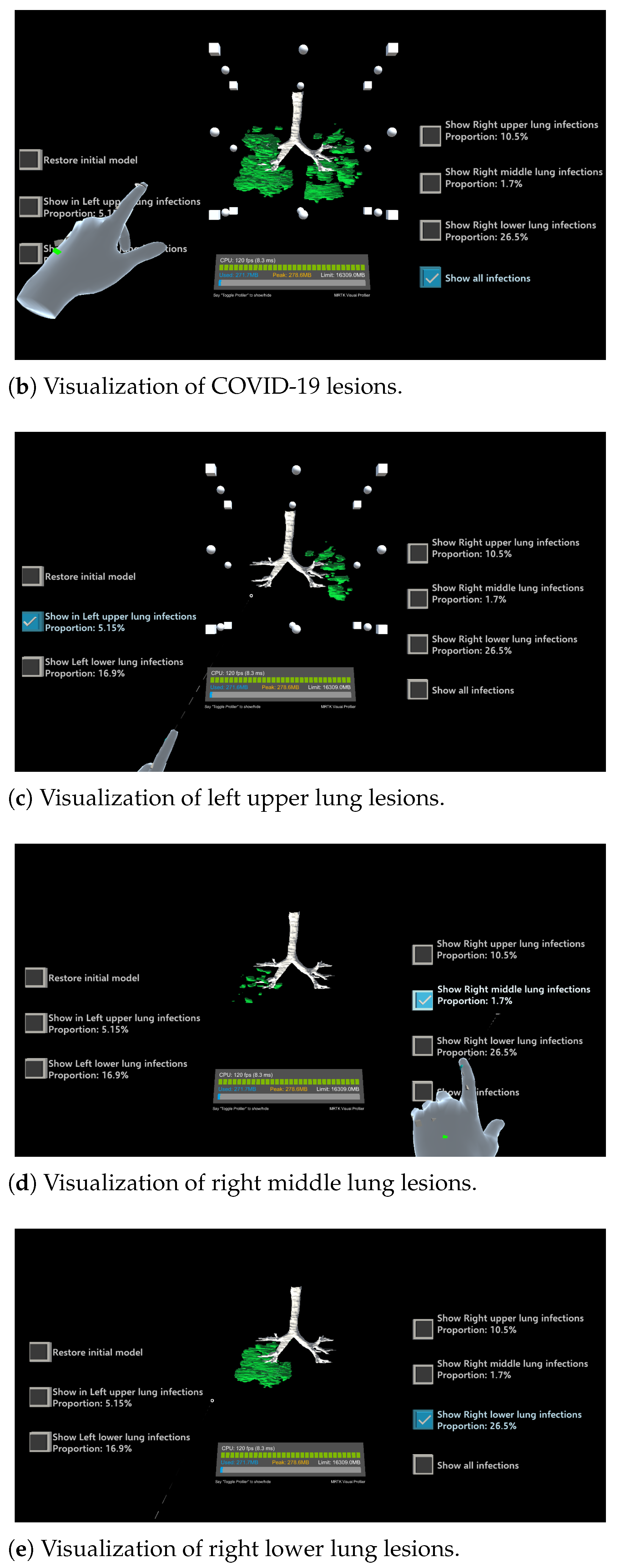 Electronics 13 01158 g008b
