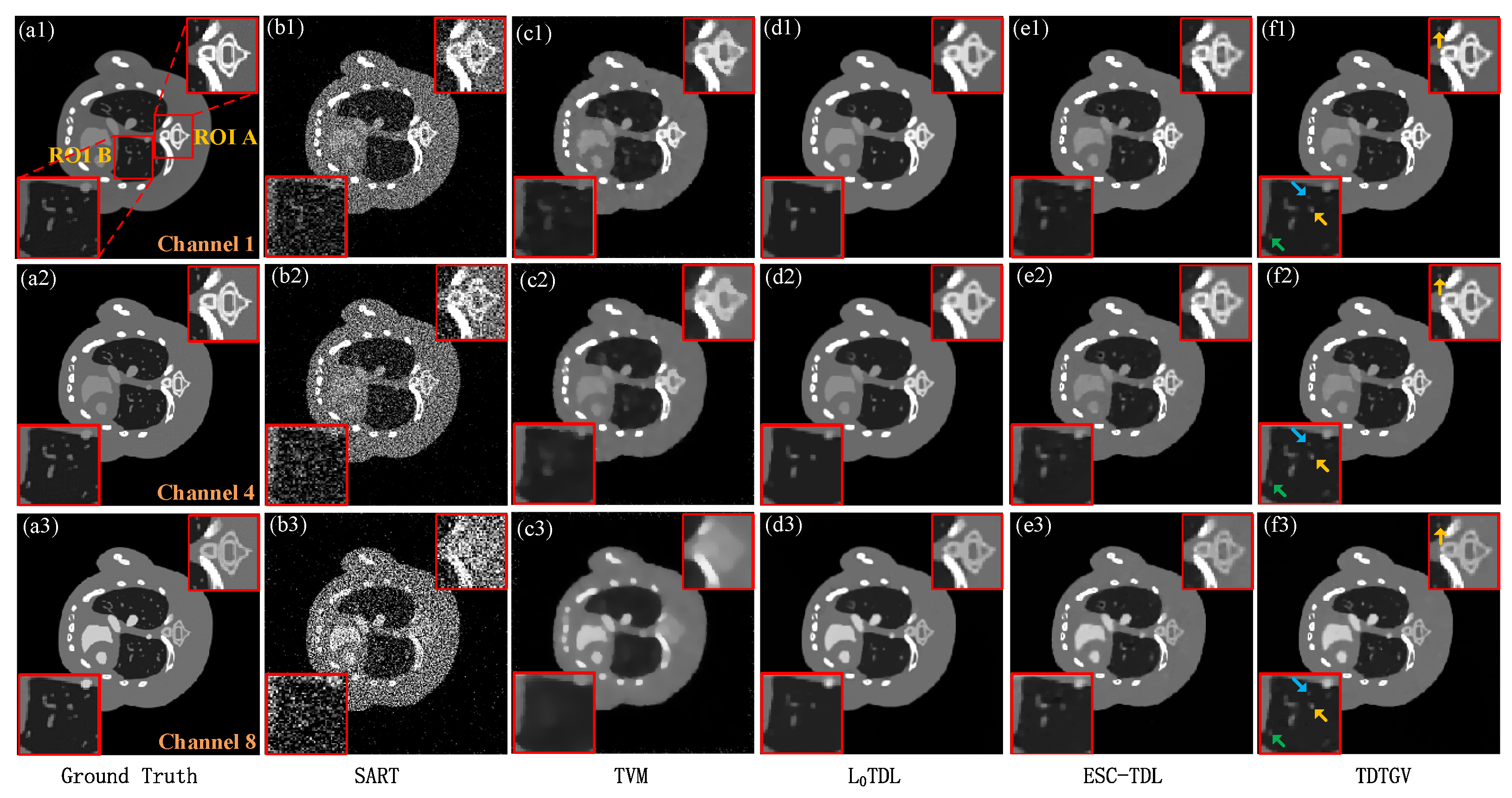 Electronics 13 01868 g004