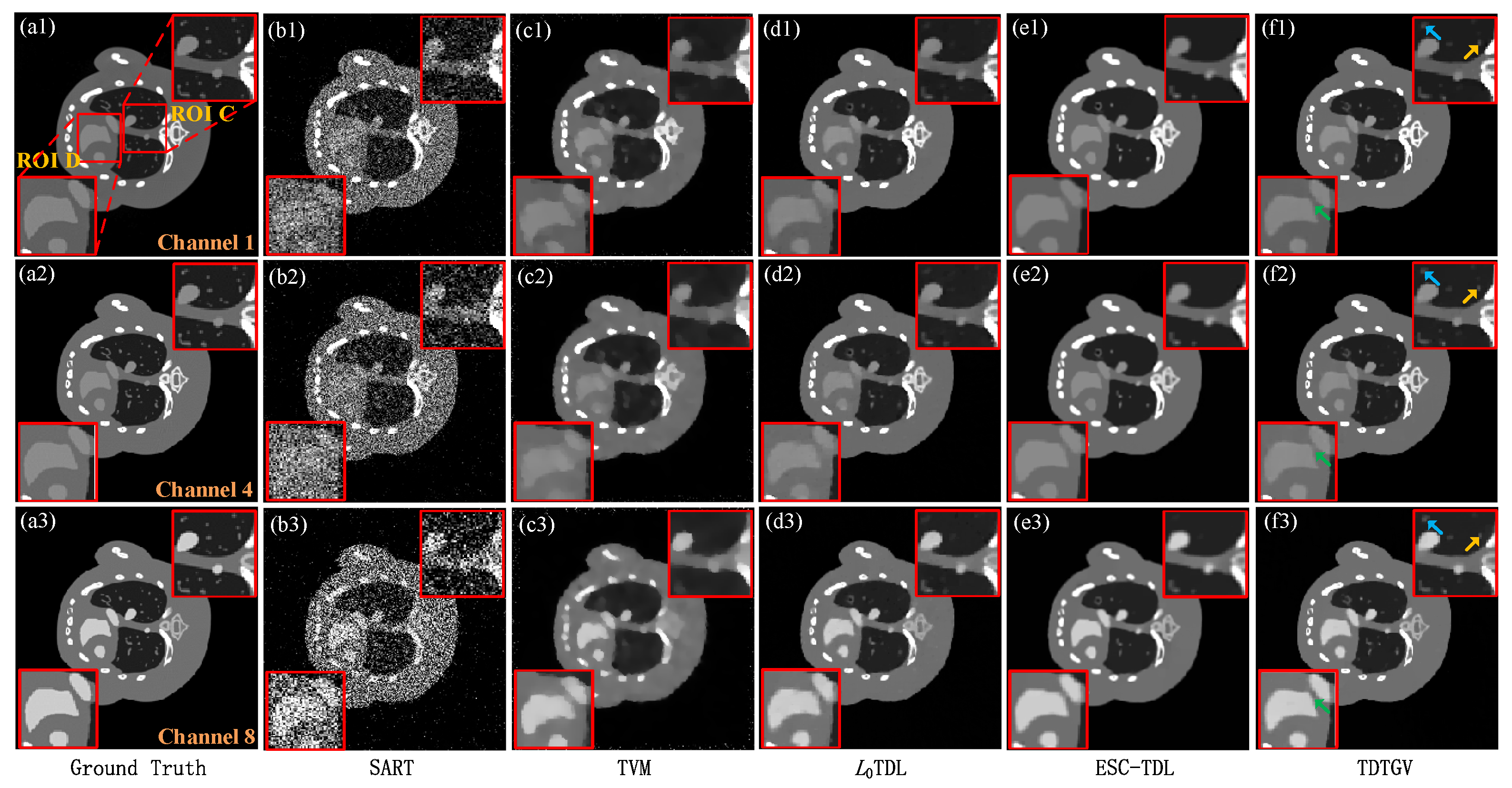 Electronics 13 01868 g005