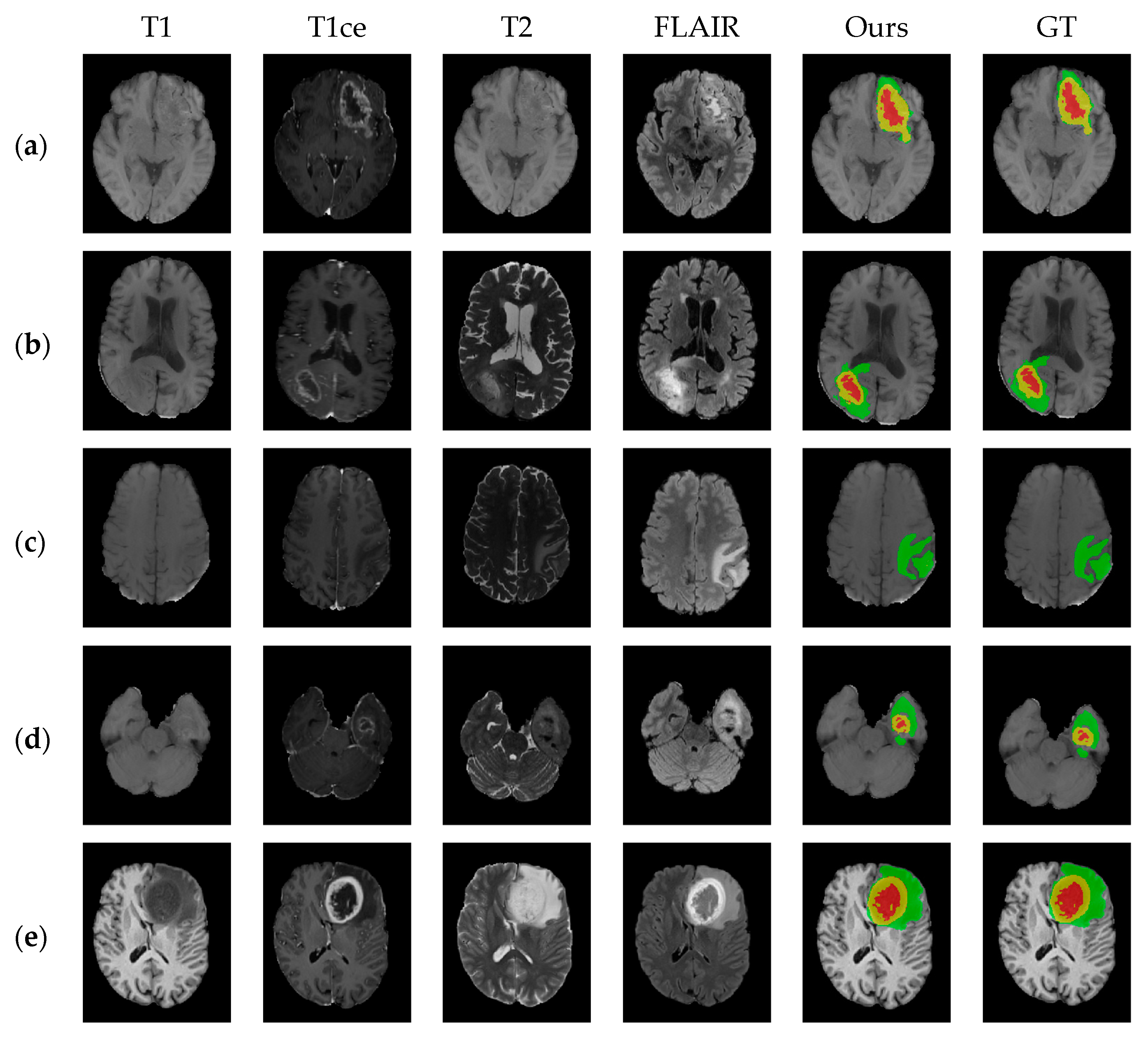 Electronics 13 01915 g007