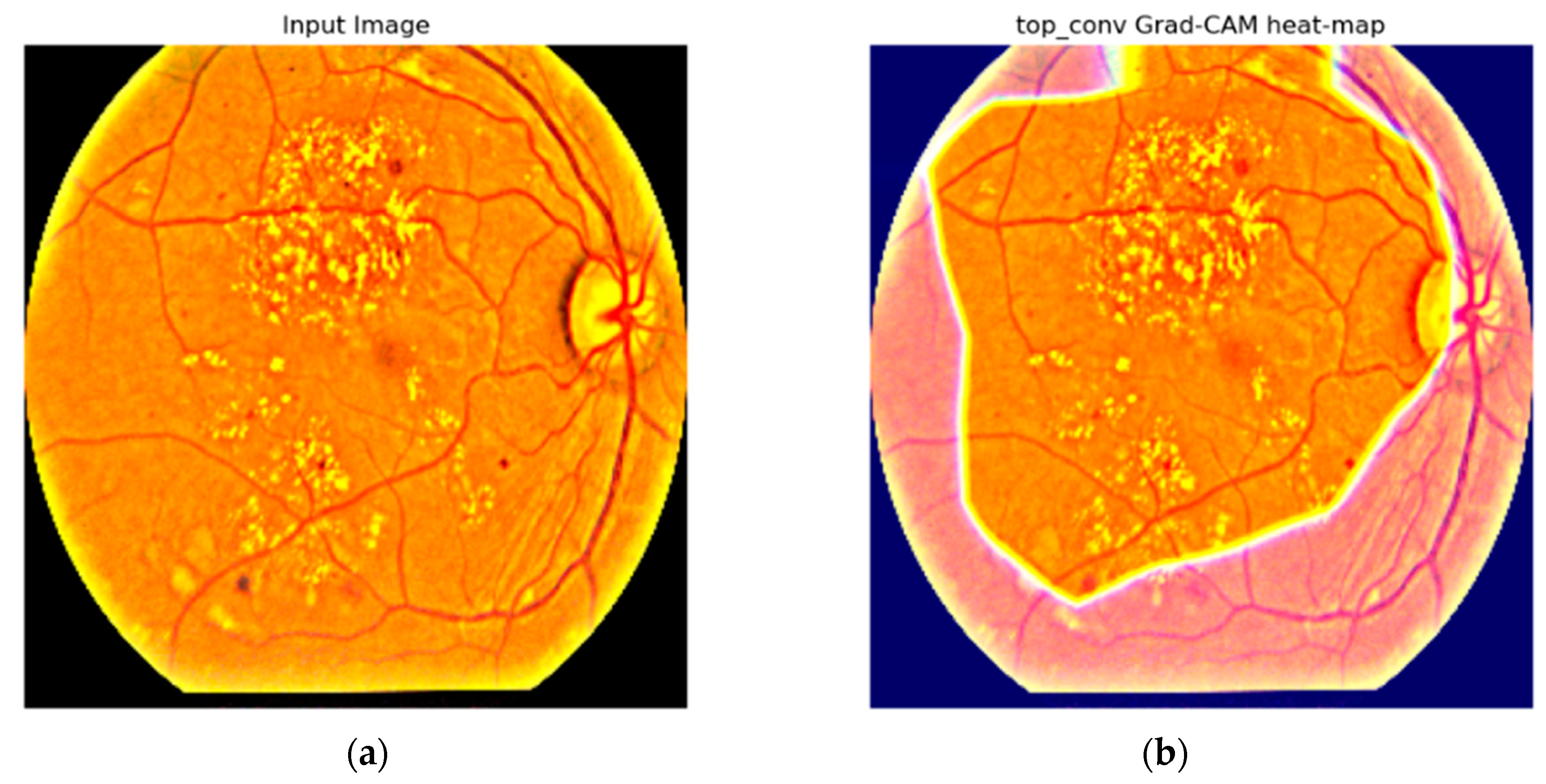 Electronics 13 02070 g013