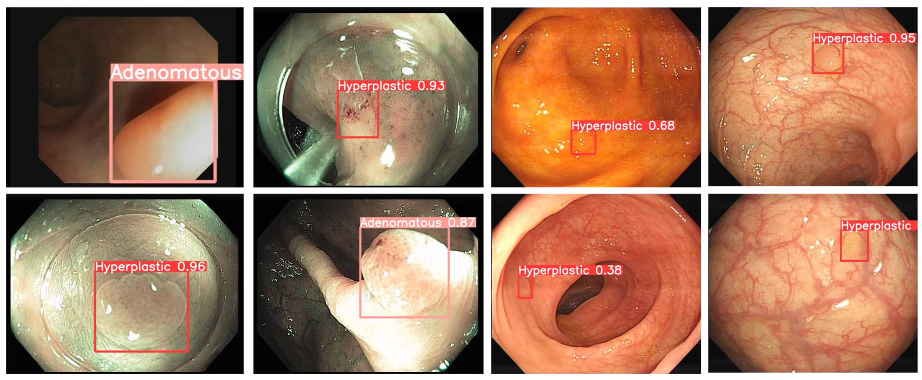 Electronics 13 02298 g014