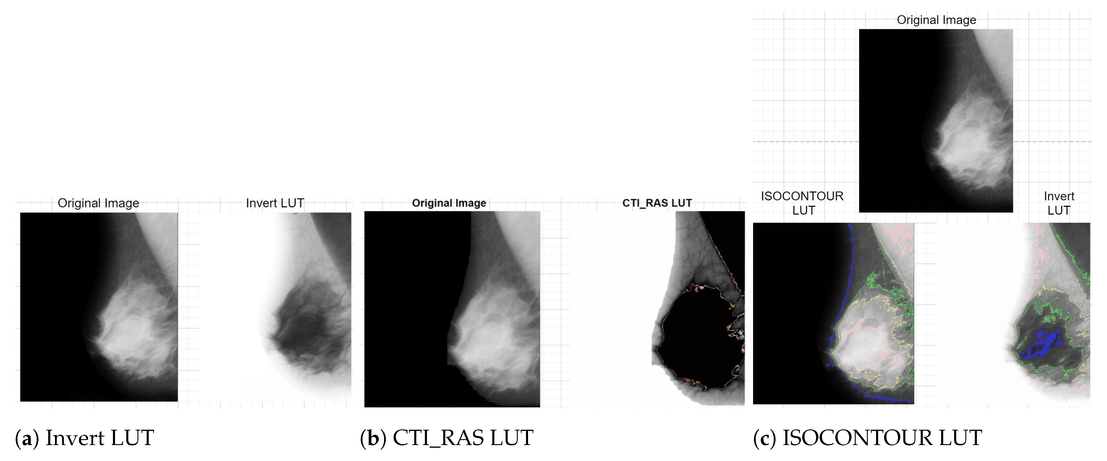 Electronics 13 03575 g005