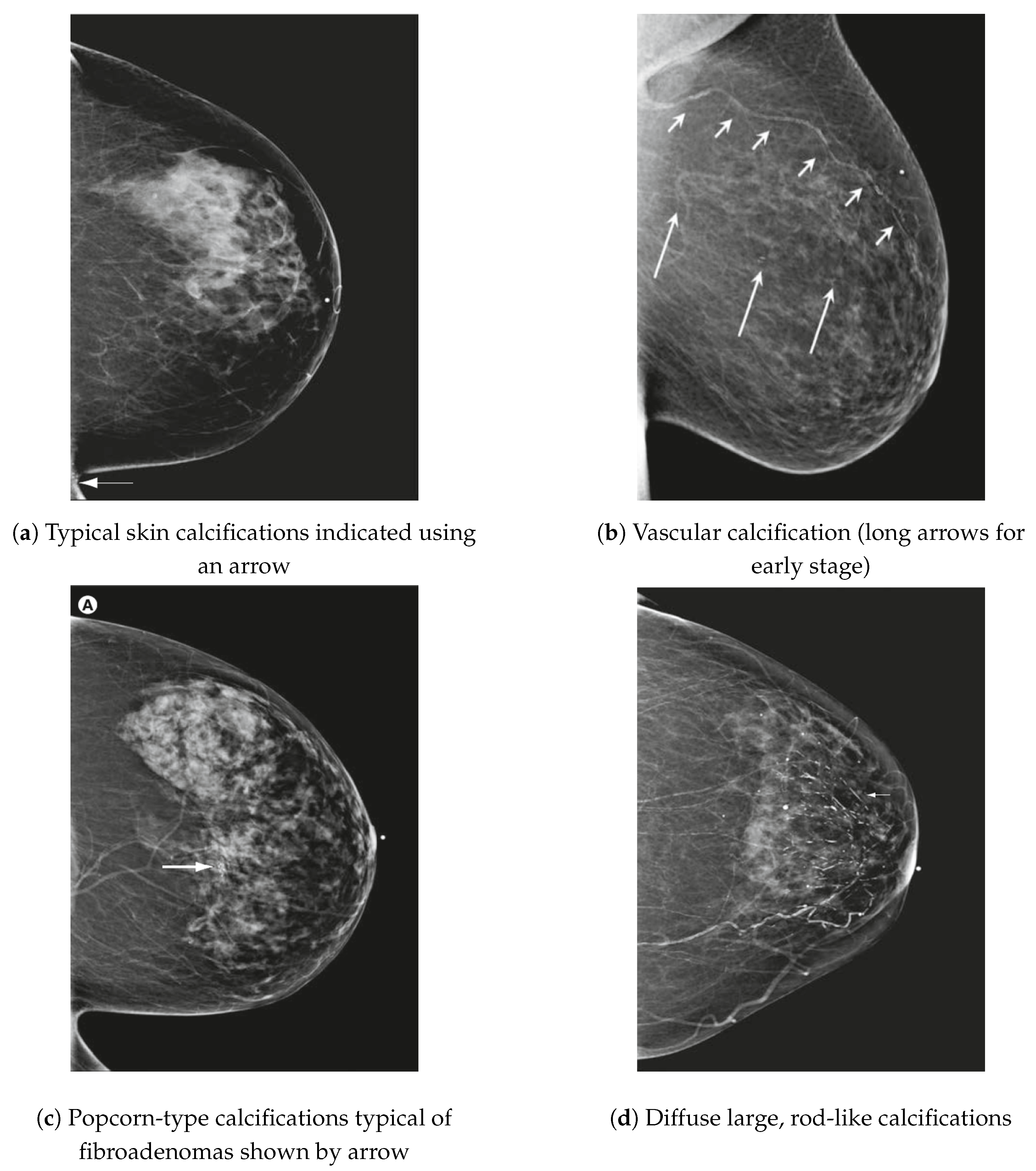 Electronics 13 03575 g006