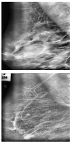 Electronics 13 03575 i008