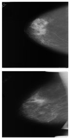 Electronics 13 03575 i010