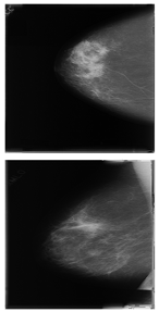 Electronics 13 03575 i011