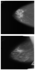 Electronics 13 03575 i012