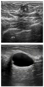 Electronics 13 03575 i014