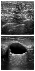 Electronics 13 03575 i015