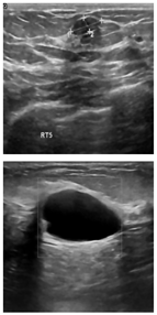 Electronics 13 03575 i016