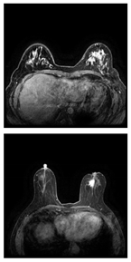 Electronics 13 03575 i018