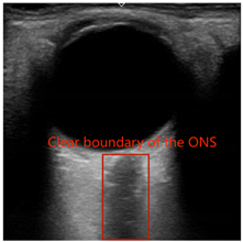 Electronics 13 03595 i001