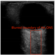 Electronics 13 03595 i002