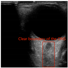 Electronics 13 03595 i003