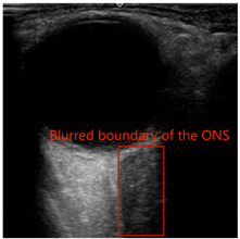 Electronics 13 03595 i004