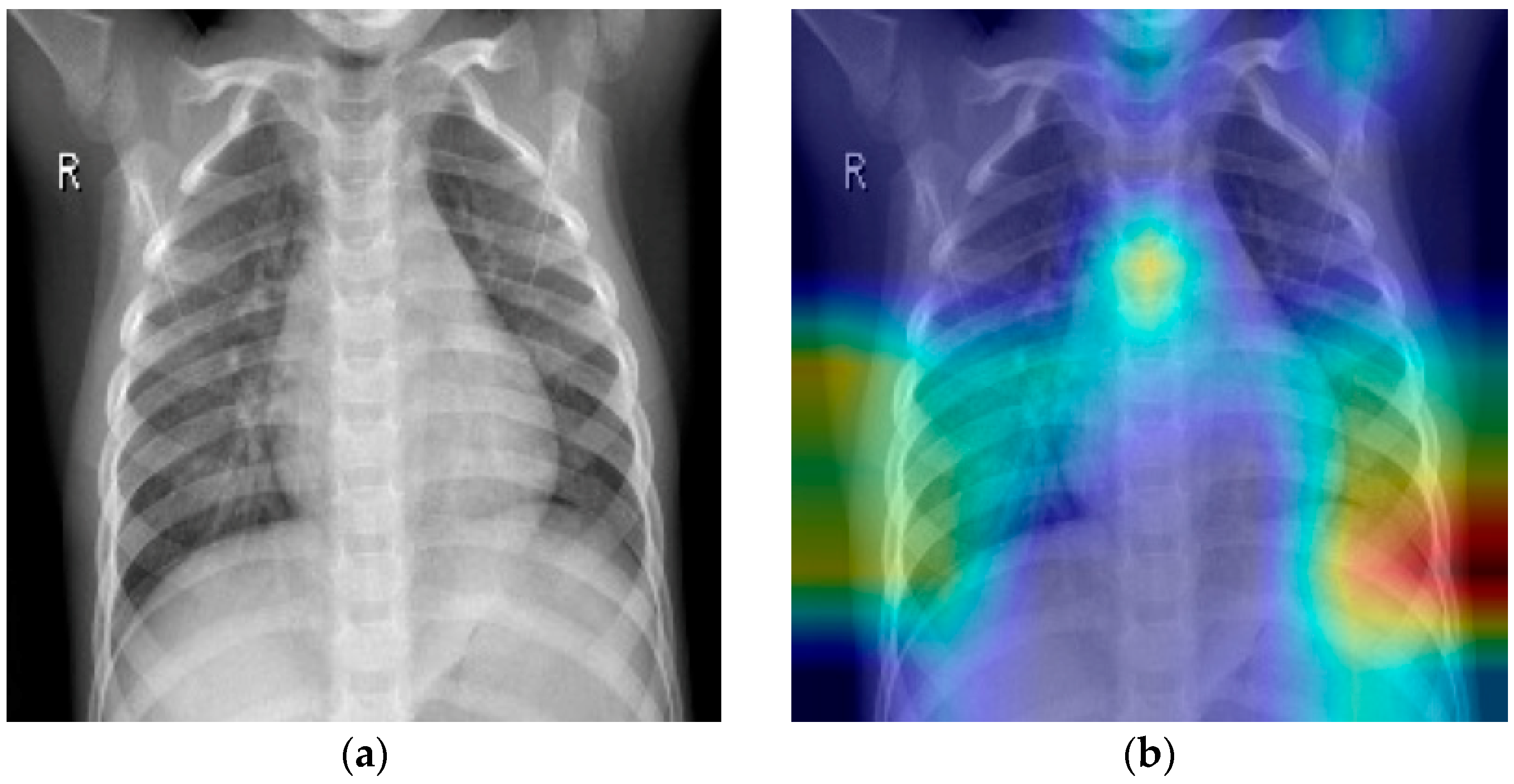 Electronics 13 04042 g004