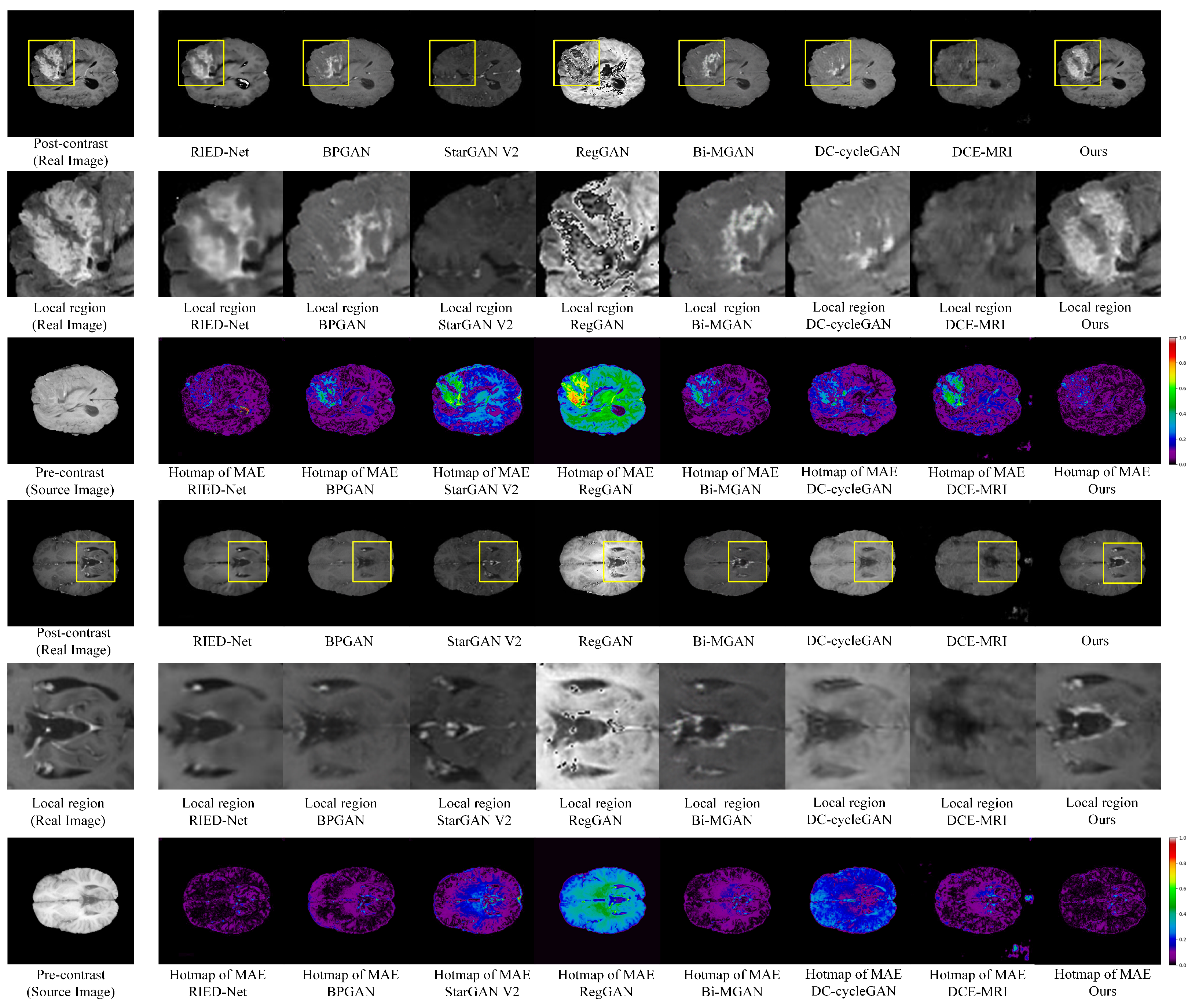 Electronics 13 04351 g005