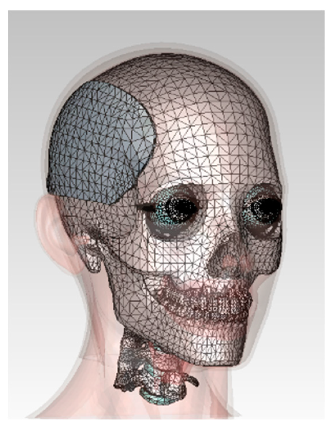 Electronics 13 04551 g003