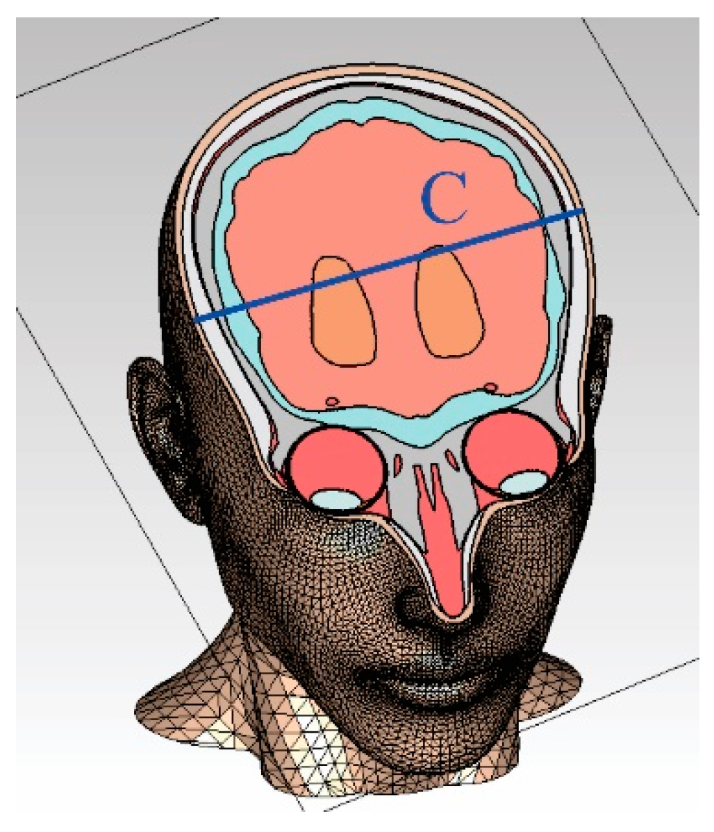 Electronics 13 04551 g006