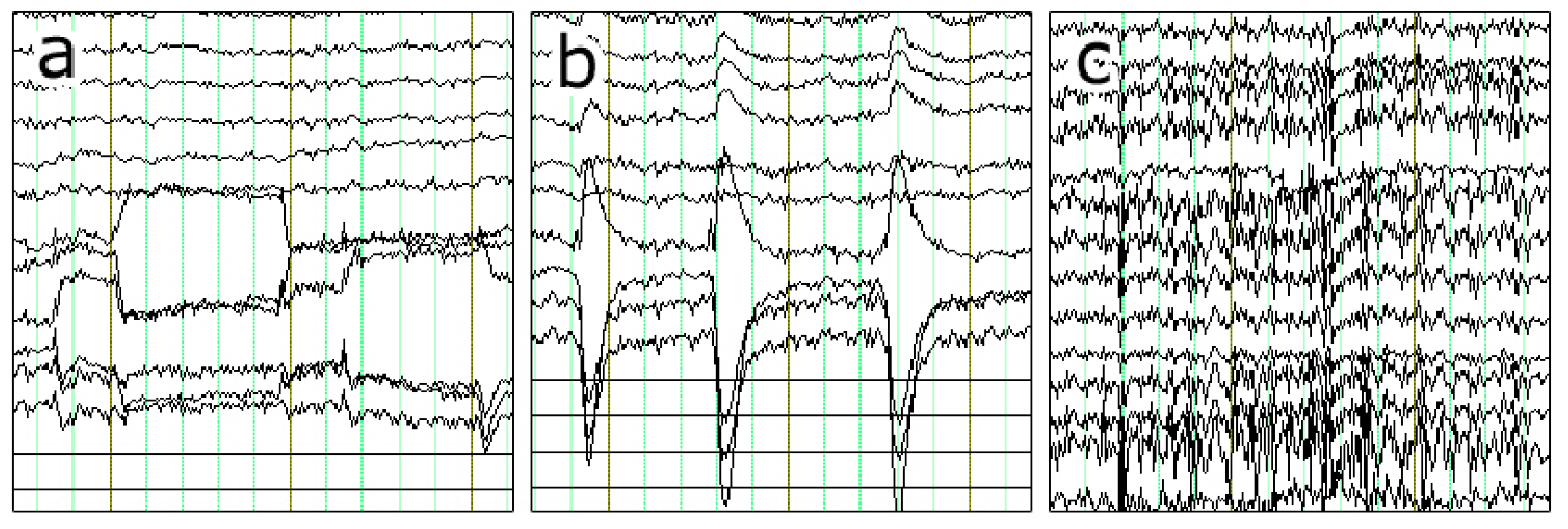 Electronics 13 04576 g001