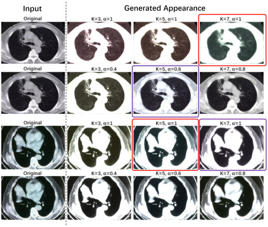 Electronics 13 04594 g004