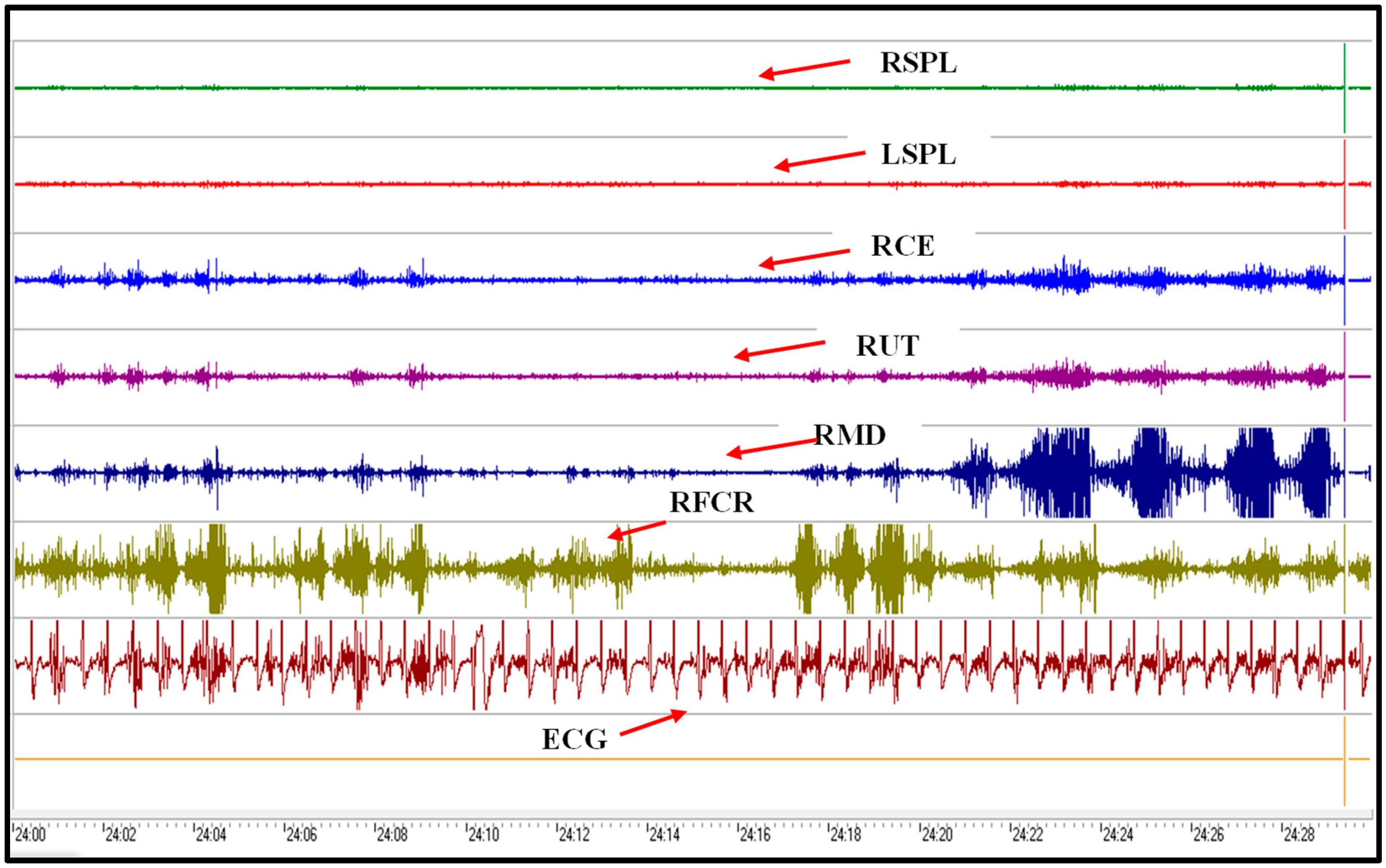 Electronics 13 04637 g007