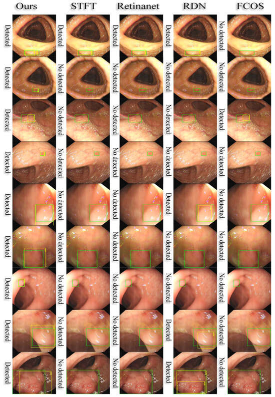 Electronics 14 00062 g0a1