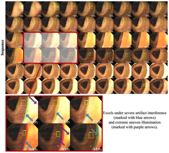 Electronics 14 00062 g0a2