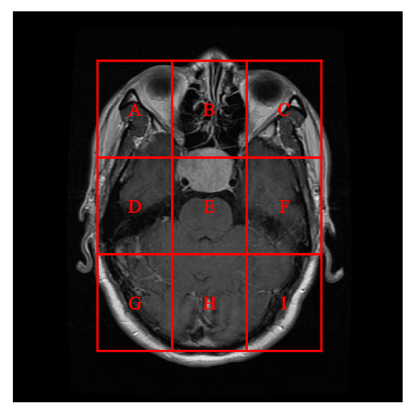 Electronics 14 00122 g014