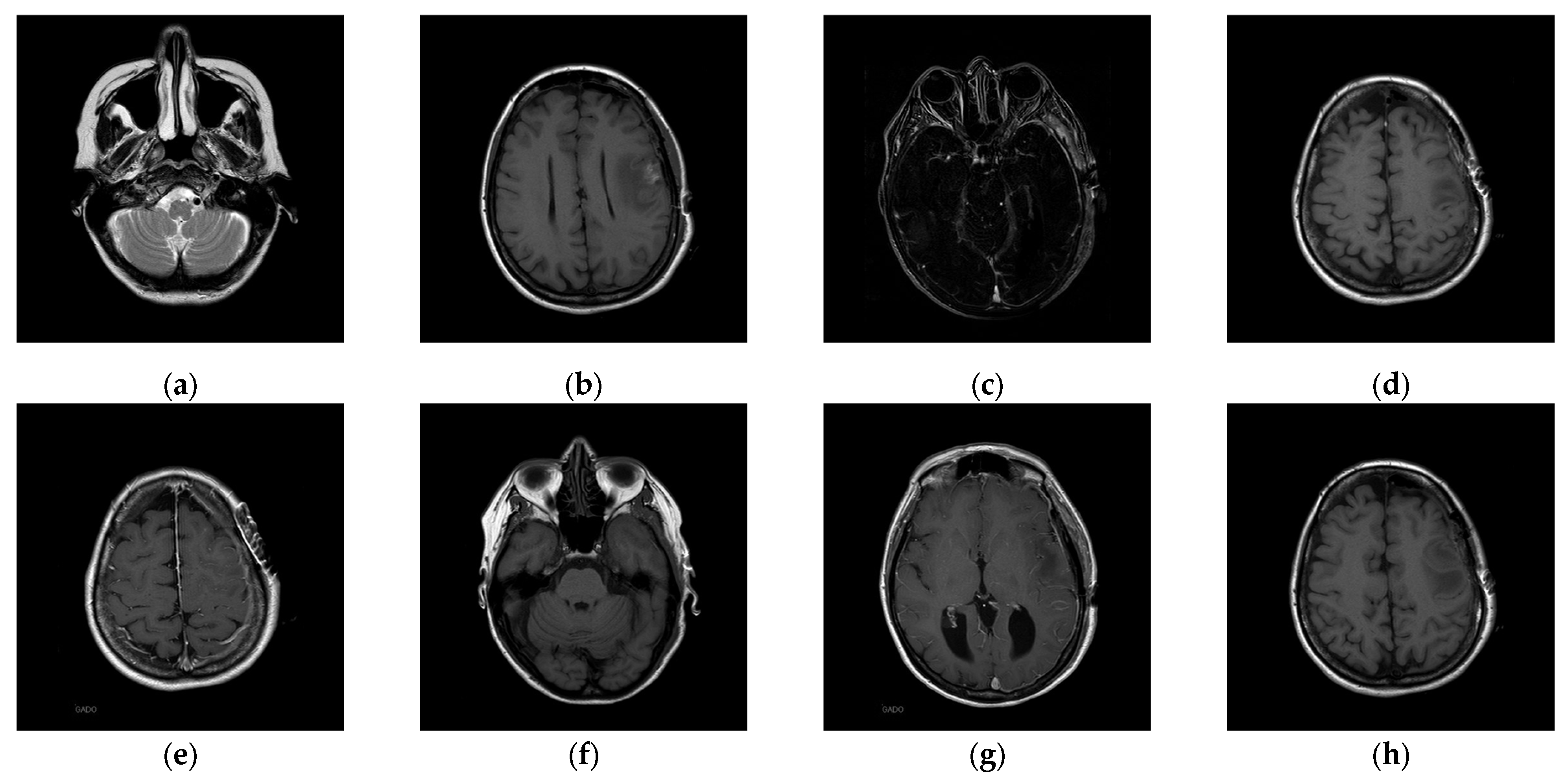 Electronics 14 00122 g016