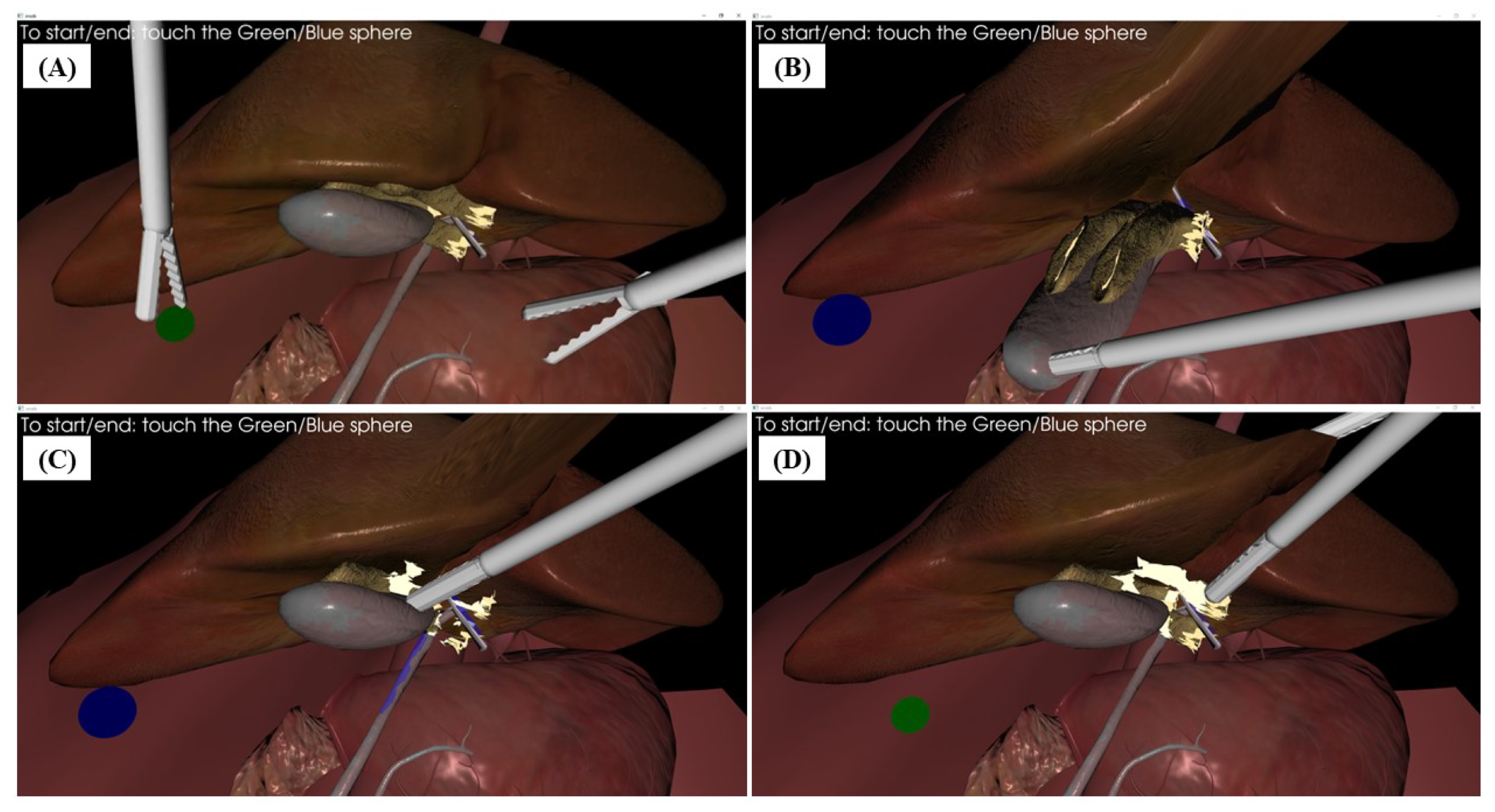 Electronics 14 00793 g010