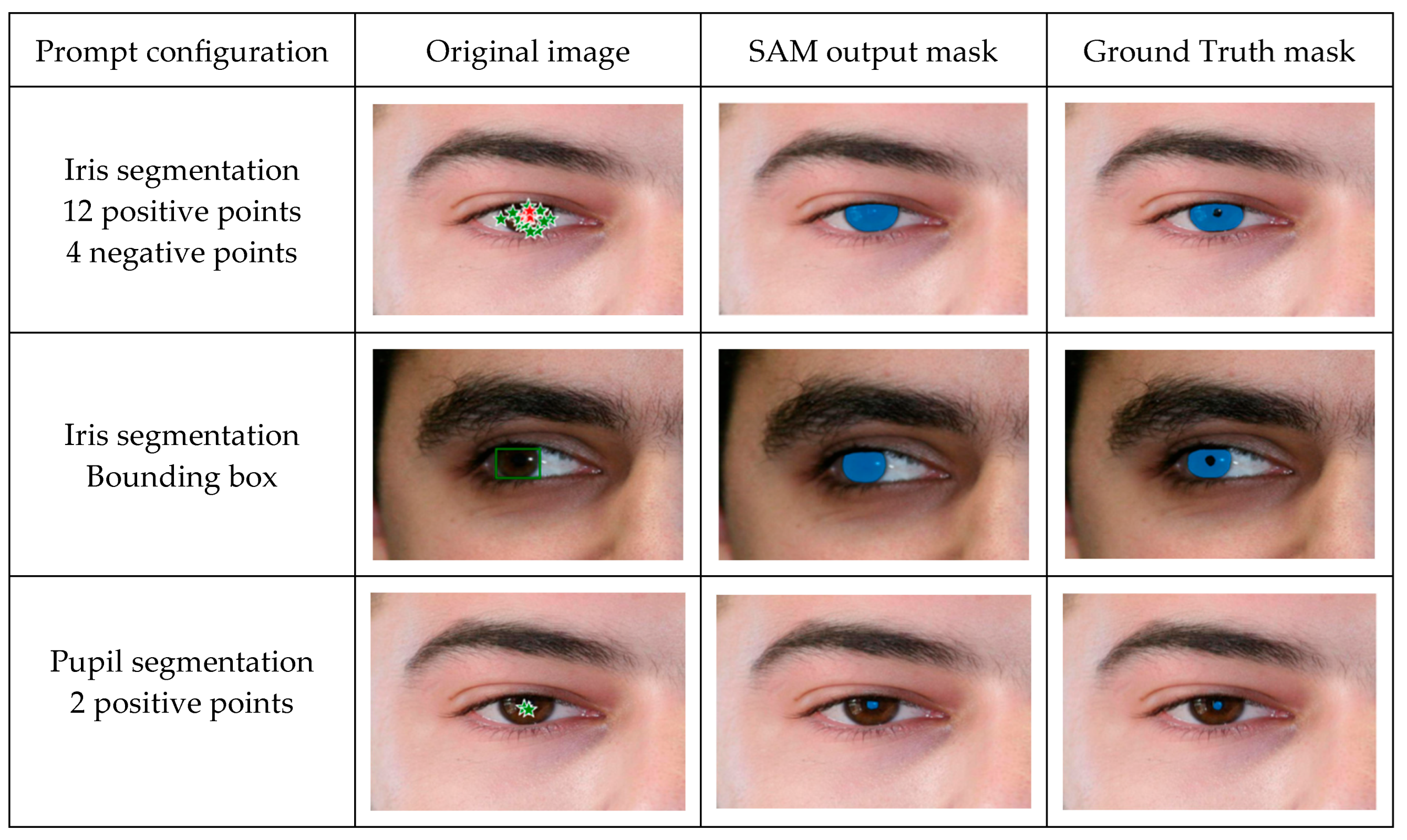 Adapting SAM for Visible-Light Pupil Segmentation Baseline | MDPI