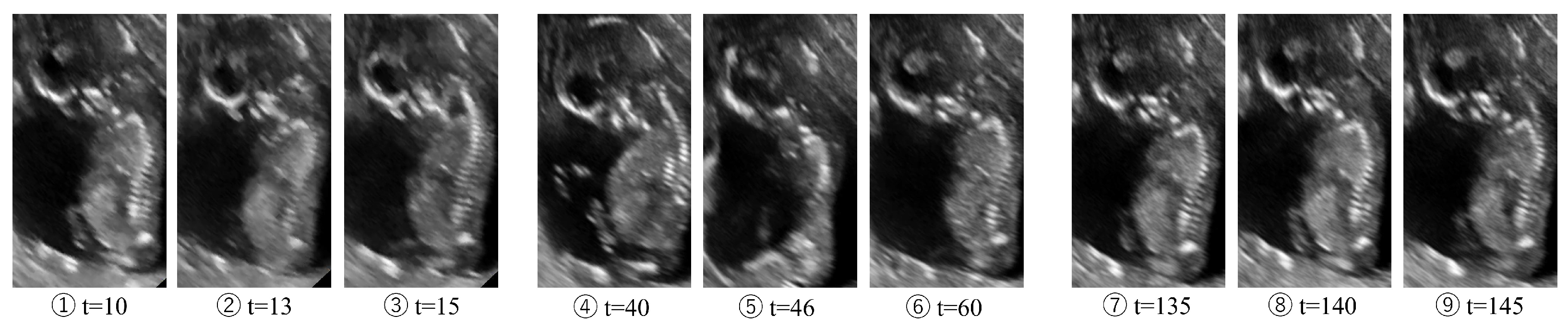 Electronics 14 02131 g016