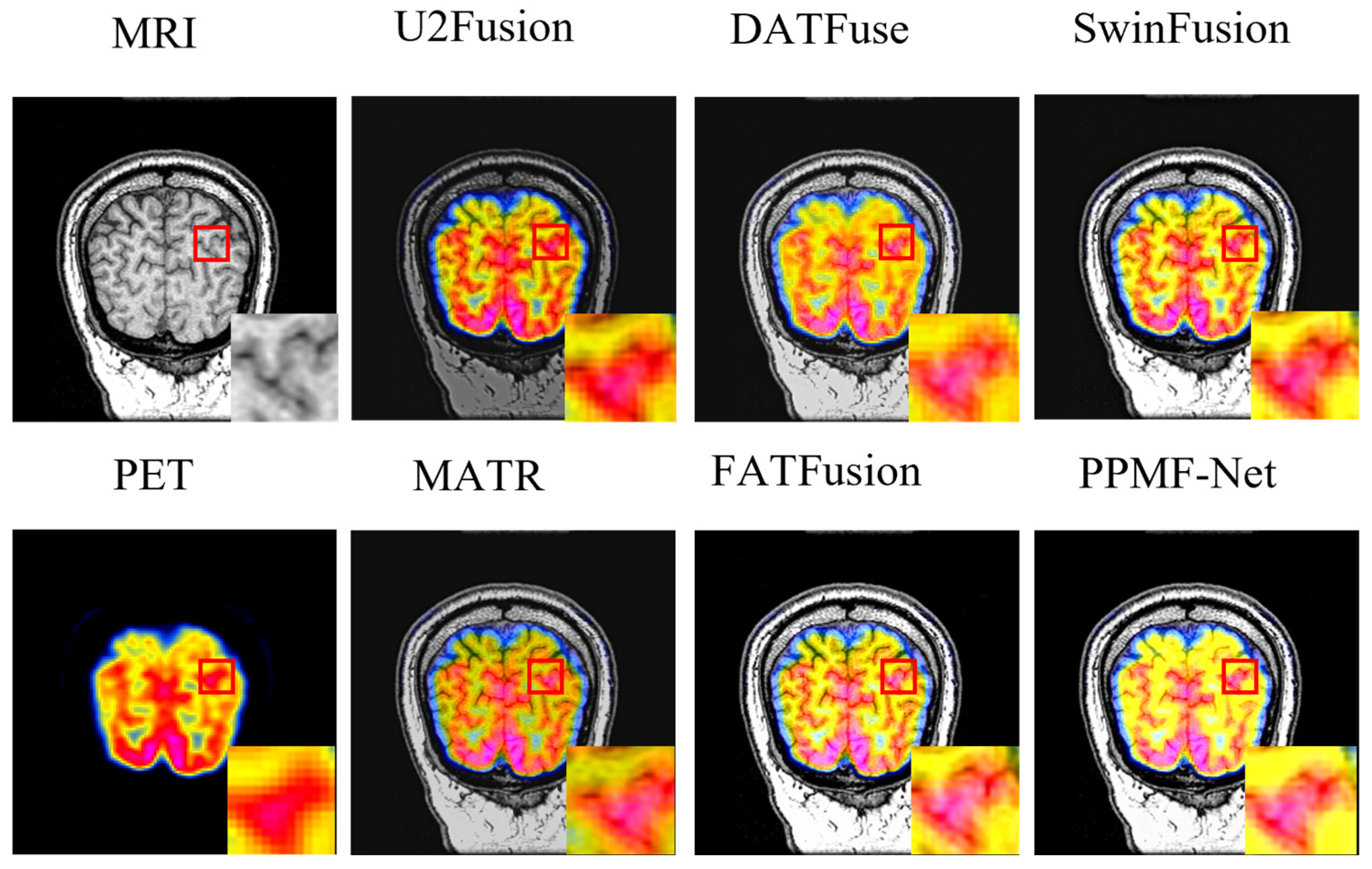 Electronics 14 02266 g005