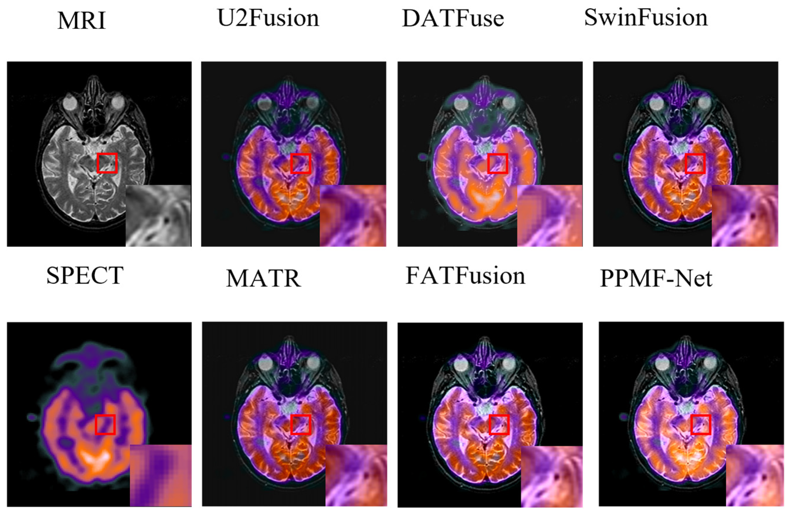 Electronics 14 02266 g006