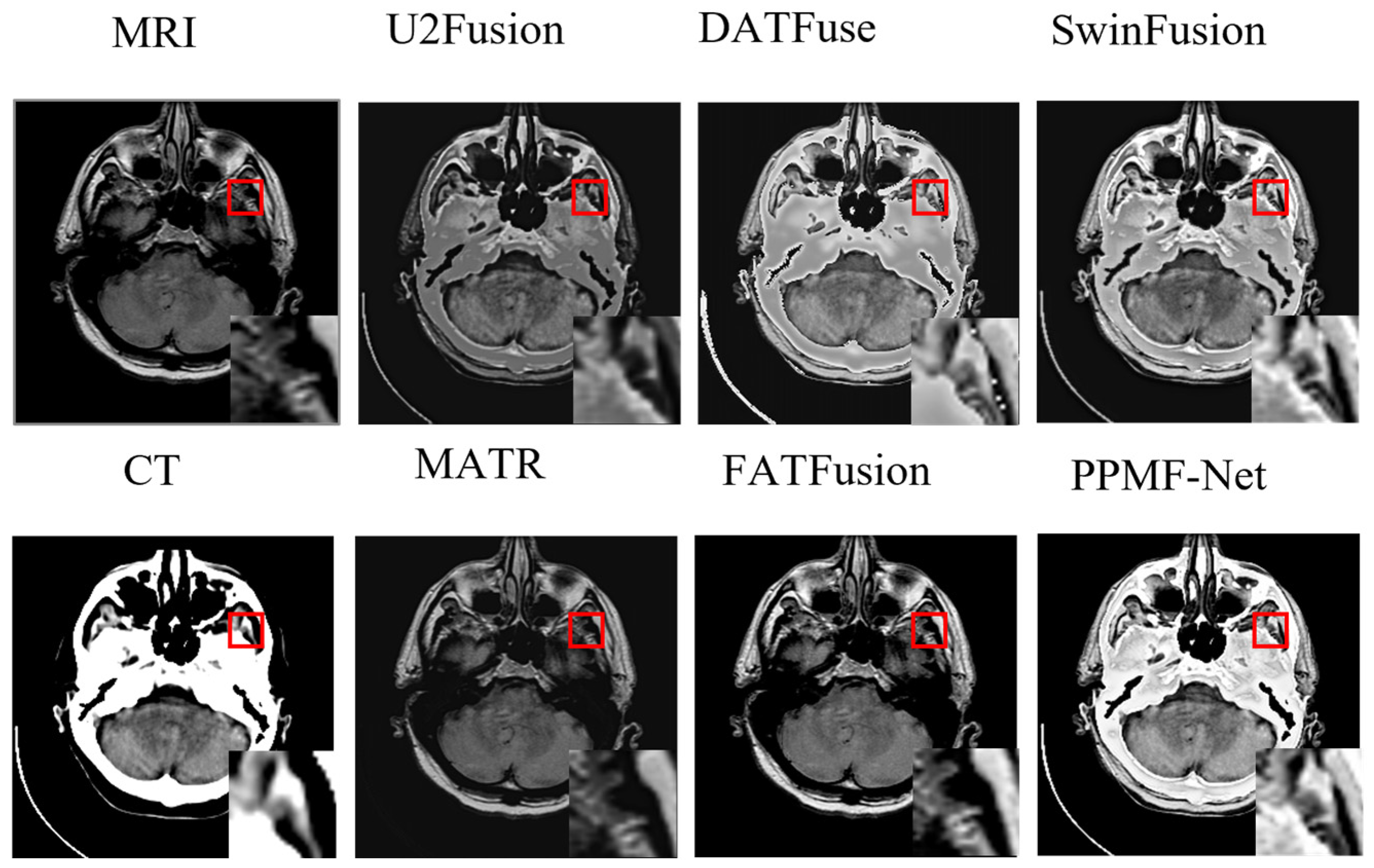 Electronics 14 02266 g007
