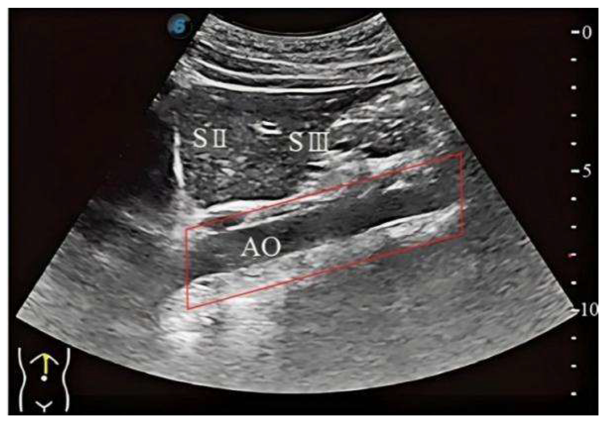 Electronics 14 03709 g003