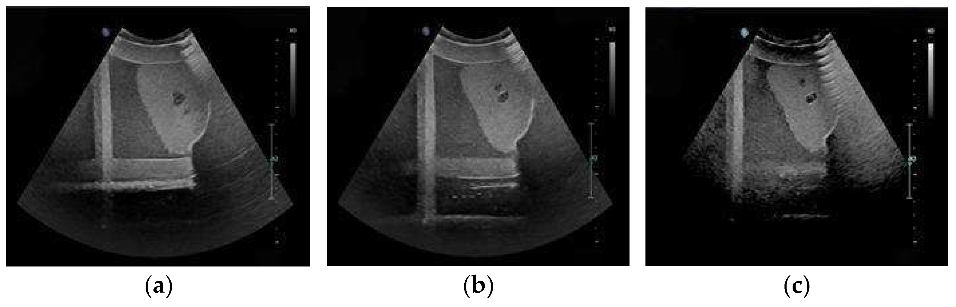 Electronics 14 03709 g011