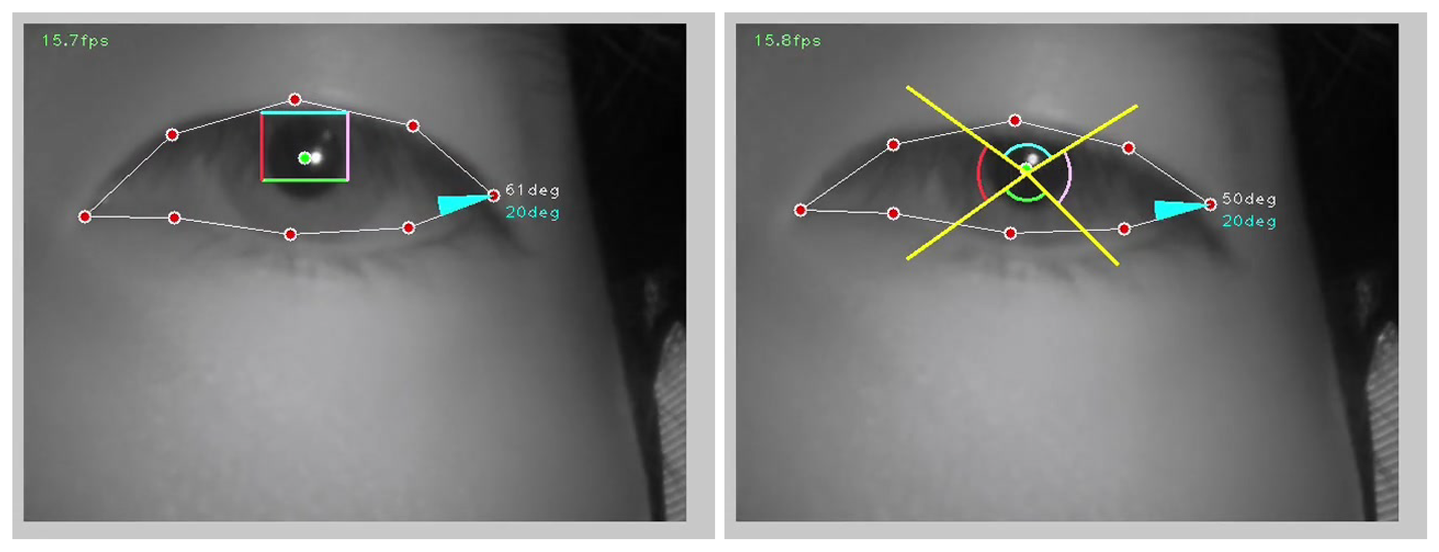 Electronics 14 04201 g005