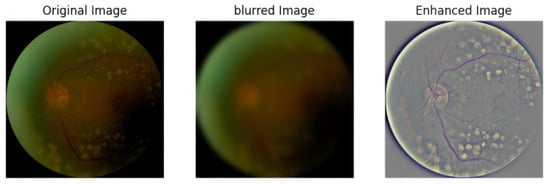 Electronics 14 04564 g004