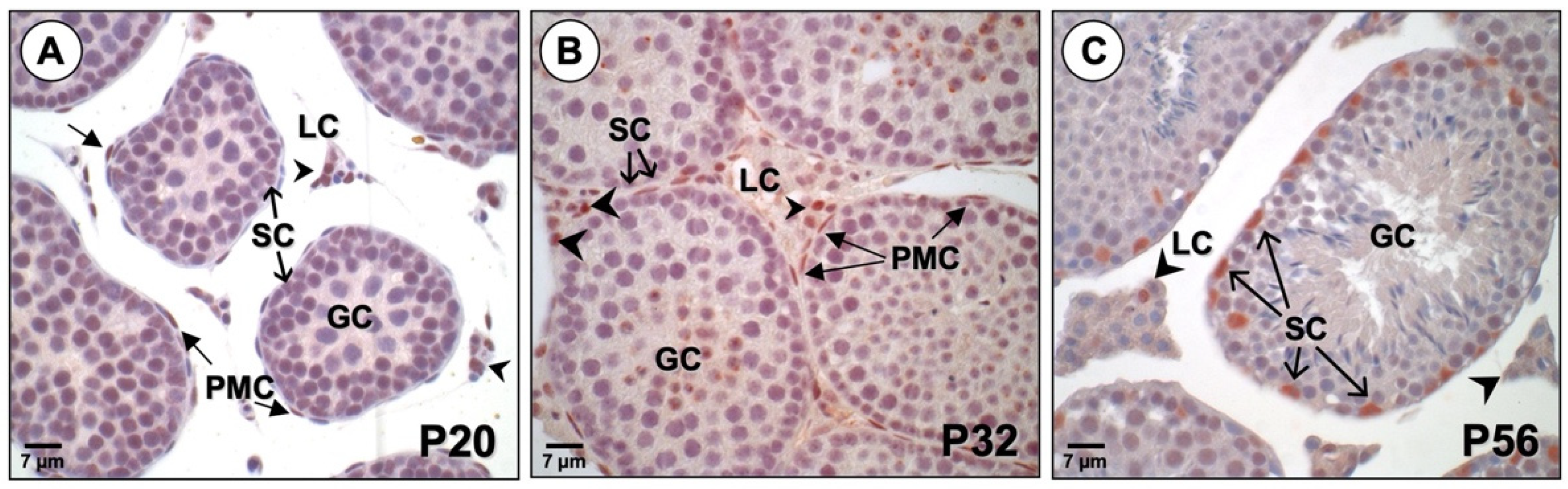 Endocrines 03 00002 g004